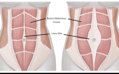 Why You Should NOT Fear a Diastasis Rectus